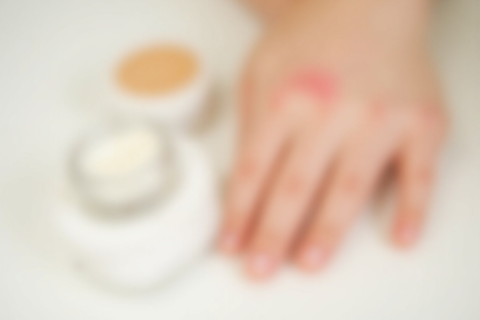 Kosmetik-Allergie – Rote, gereizte Haut im Gesicht